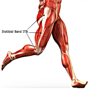 Iliotibial Band Friction Syndrome